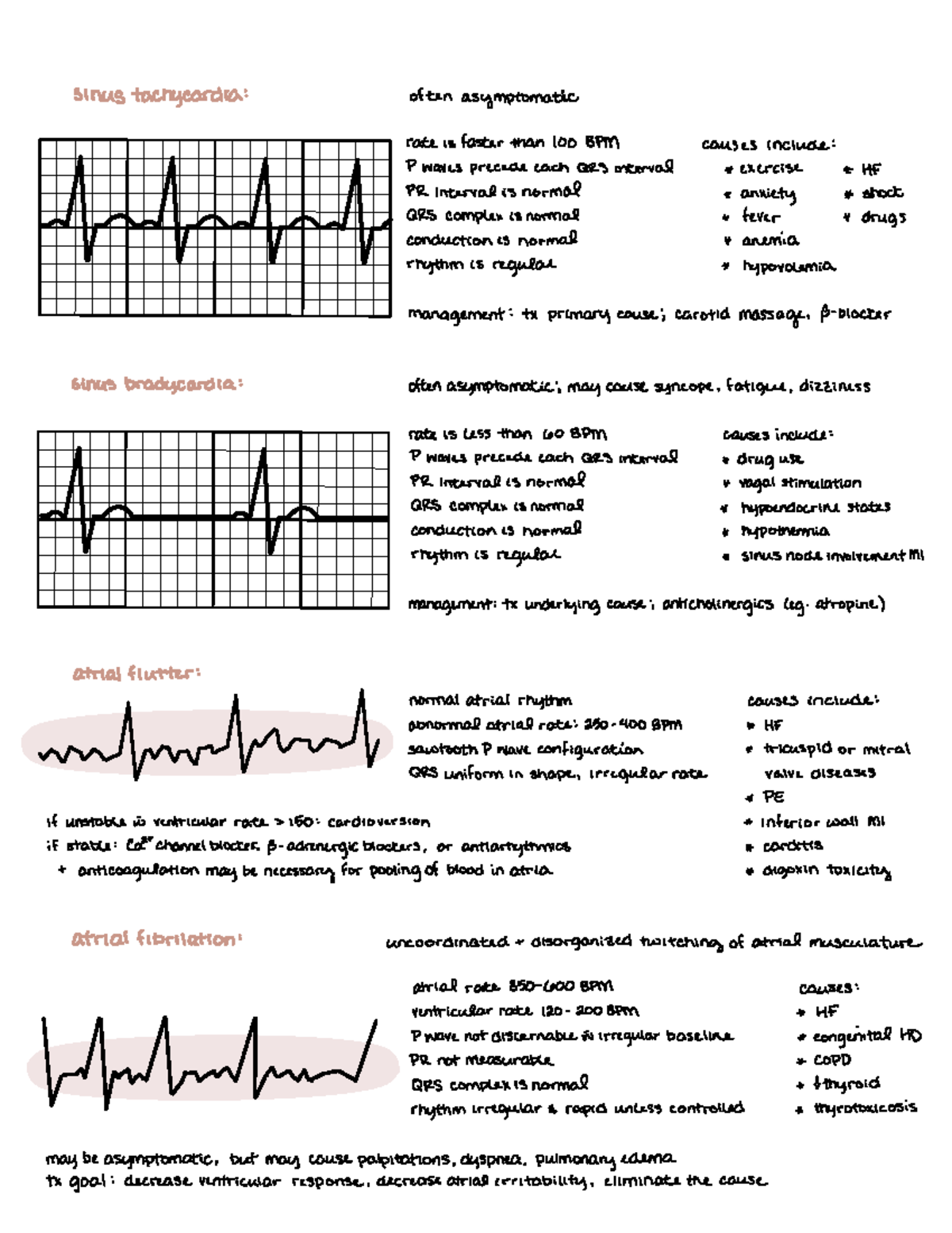 Ecg Common Rhythms - Quick Reference - Sinus ####### Tachycardia 