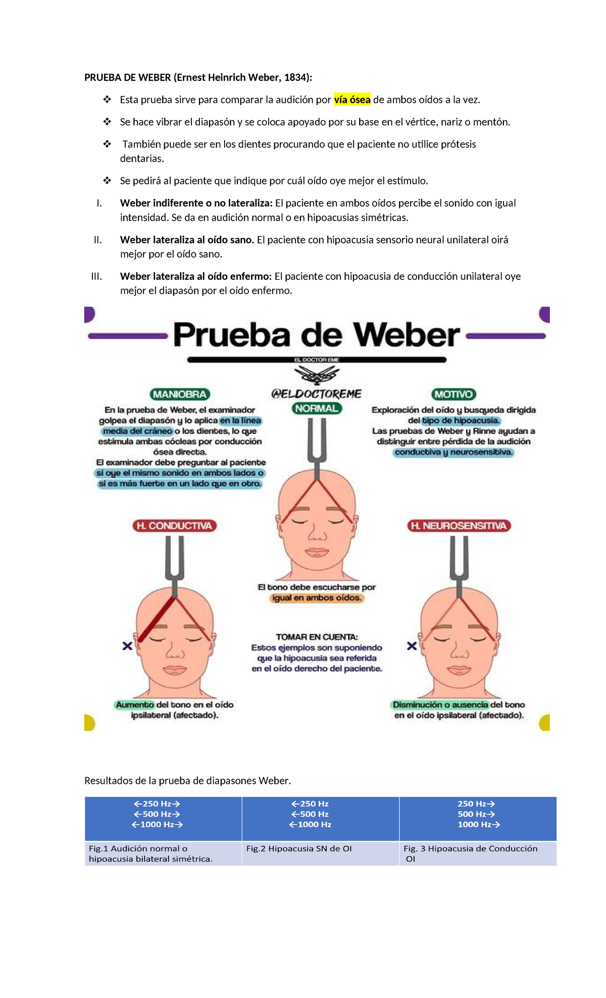 Otorrino Practico - clases practicas - PRUEBA DE WEBER (Ernest Heinrich ...