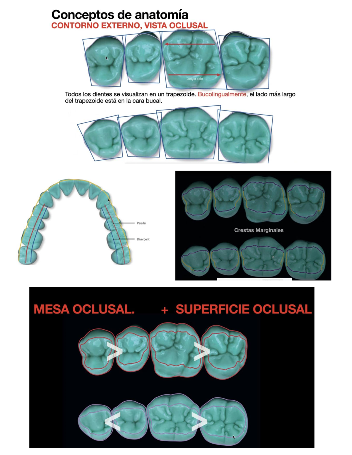 Operatoria Anatomia Apuntes Operatoría Dental Básica Clasificacion De Cavidades Las 3351