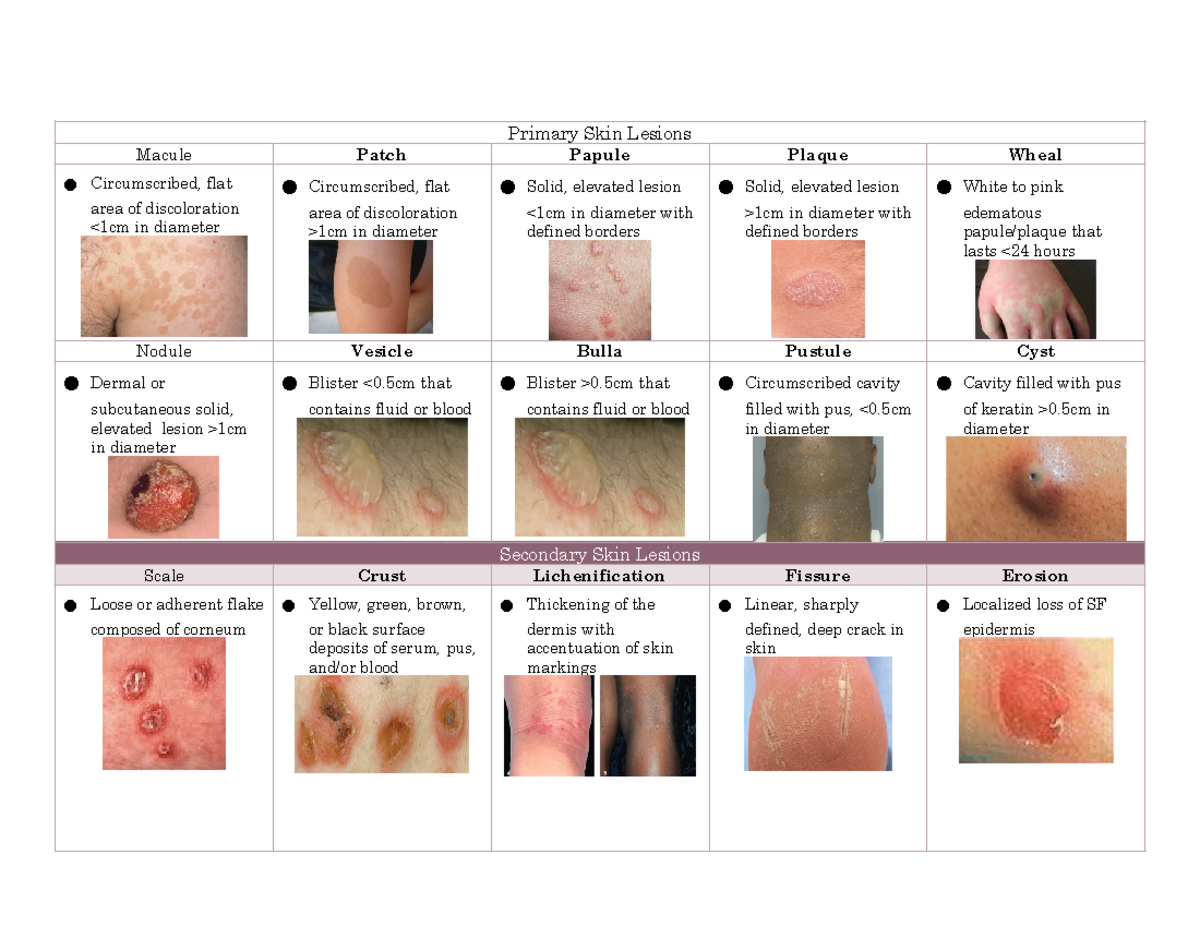 Papule Vs Macule Vs Plaque At Samantha Straus Blog