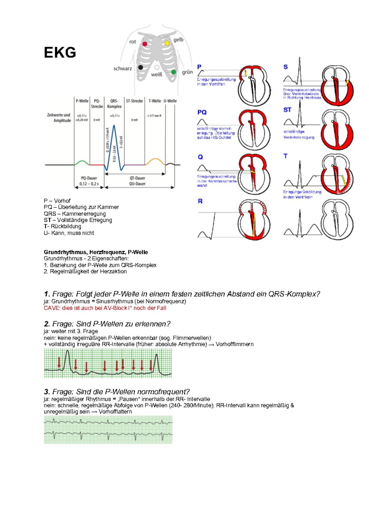 Ekg Beurteilung 7 Fragen EKG Exkurs, Zusammenfassung, Cheat Sheet, EKG für Dumme, Auswertung