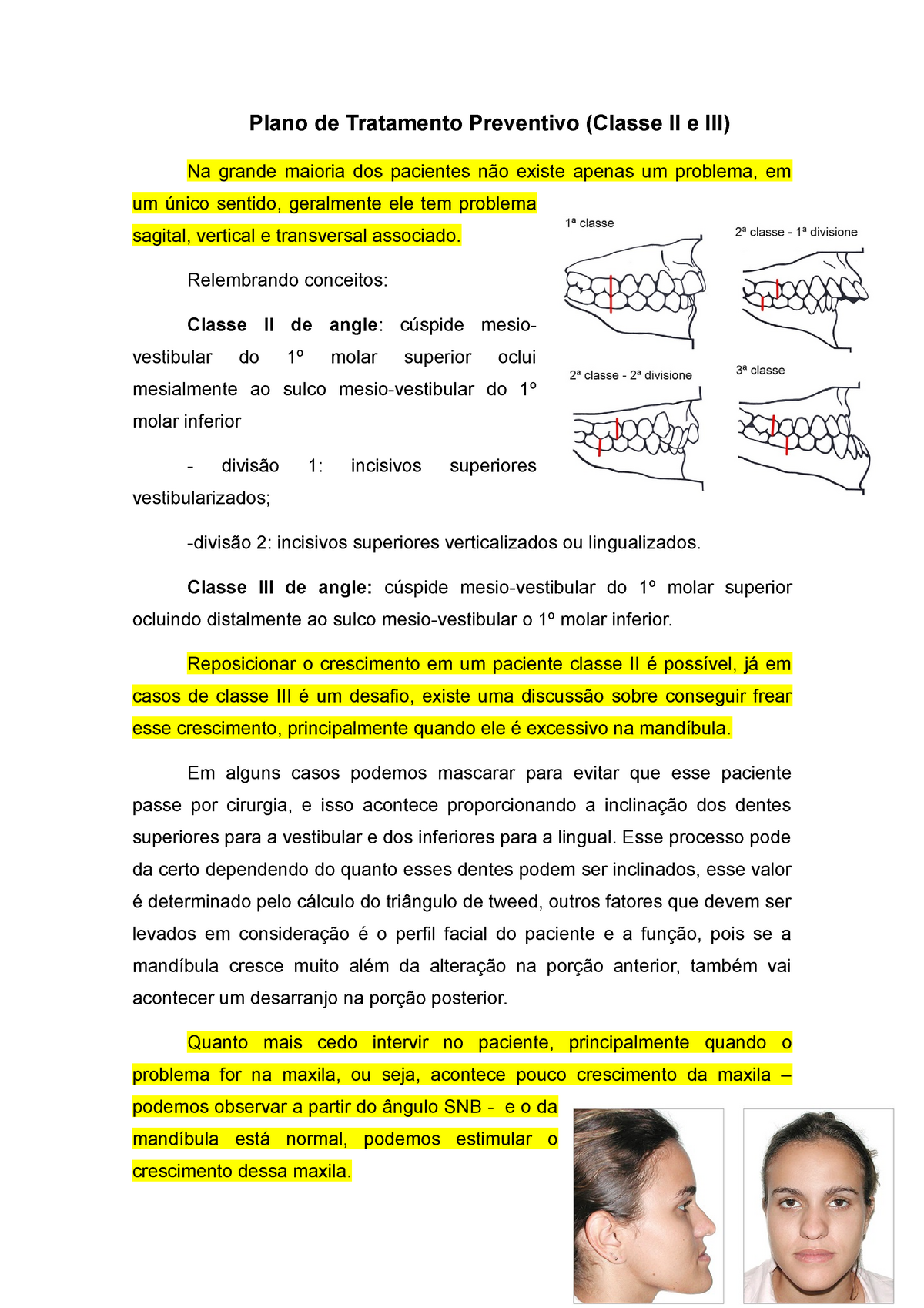 Como aproveitar seus benefícios no tratamento do paciente Classe II