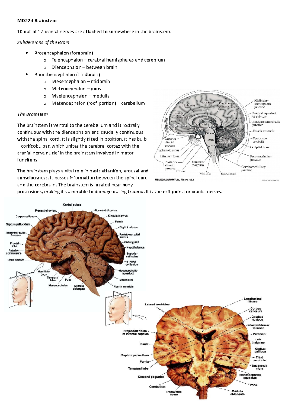 MD224 Brainstem - Subdivisions of the Brain Prosencephalon (forebrain ...