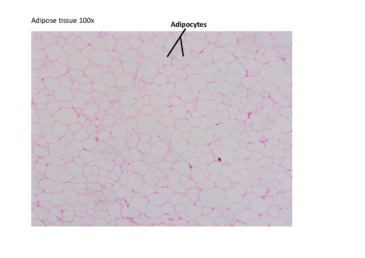 all photos of PBD Adipose tissue 100x Adipocytes Adipose tissue 400x