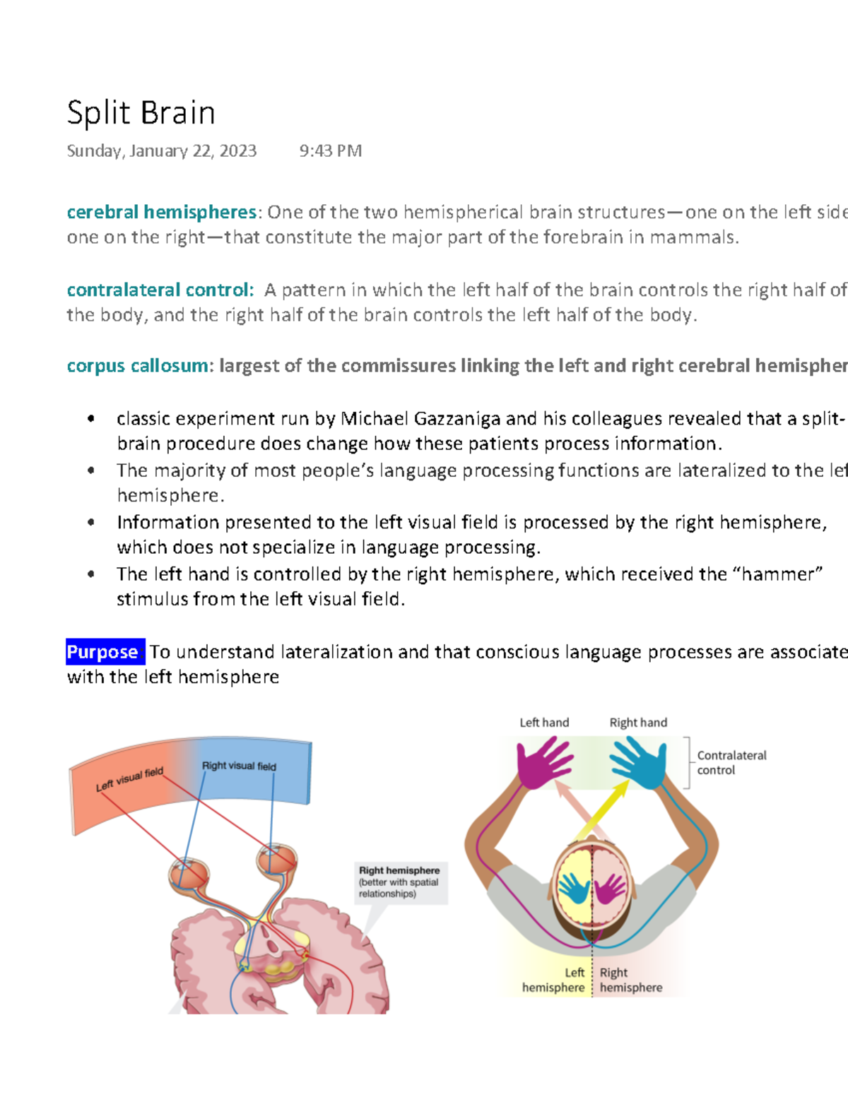 Split Brain Cerebral Hemispheres One Of The Two Hemispherical Brain   Thumb 1200 1553 