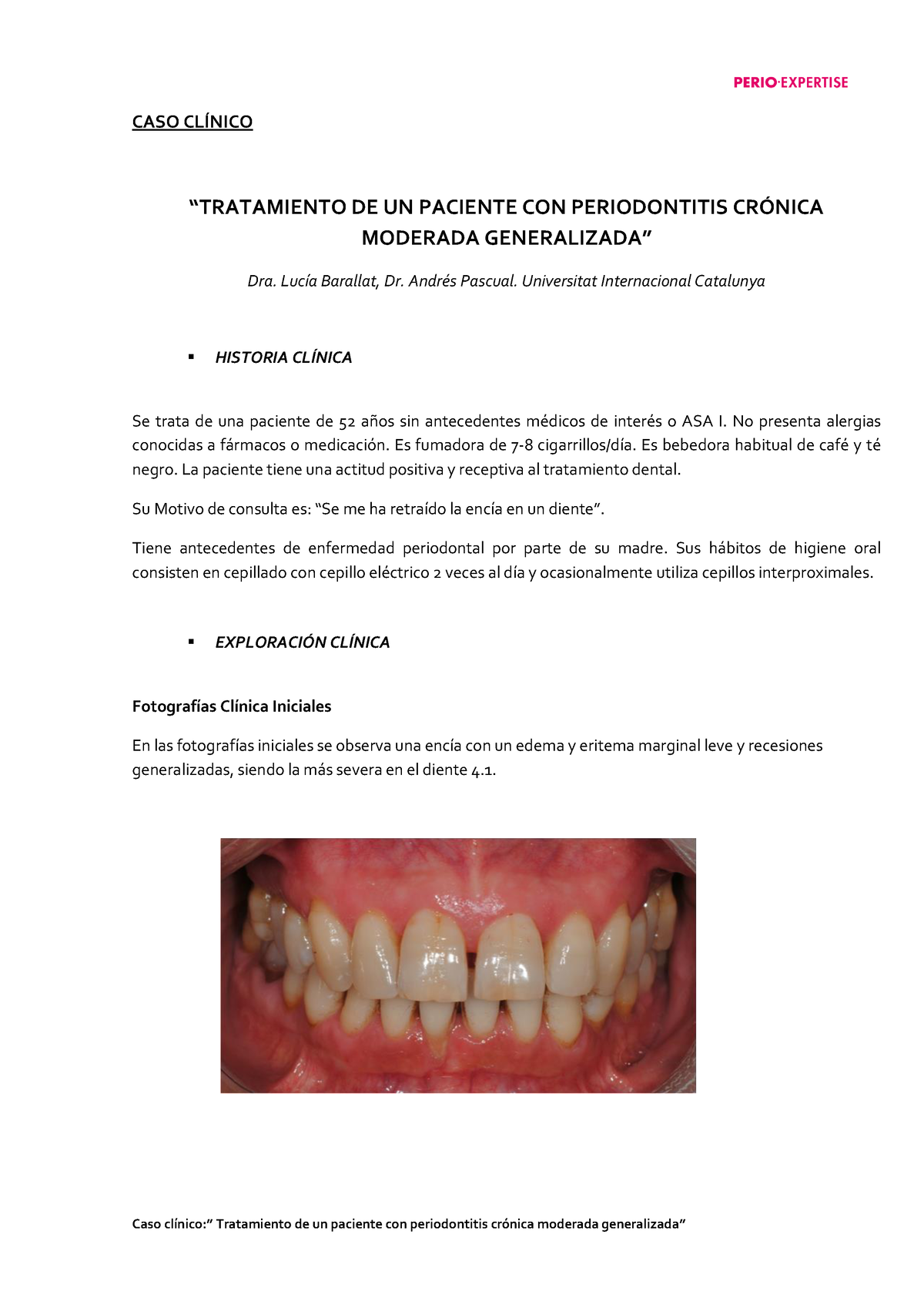 Tratamiento De Un Paciente Con Periodontitis Cronica Moderada