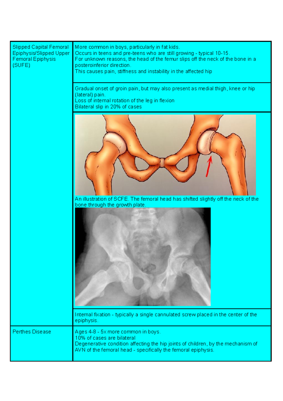 Paediatric Hip Pathology - Slipped Capital Femoral Epiphysis/Slipped ...