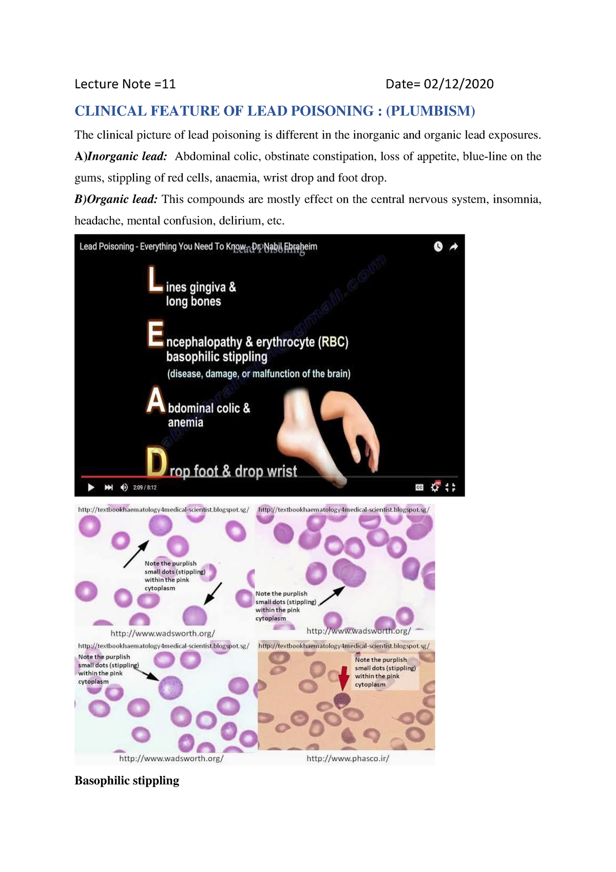 Lead occupational poisoning Lecture Note =11 Date= 02/12/ CLINICAL