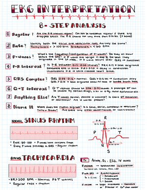 Cardiac Rhythms - rhythm cheat sheet - Normal Sinus Rhythm This rhythm ...