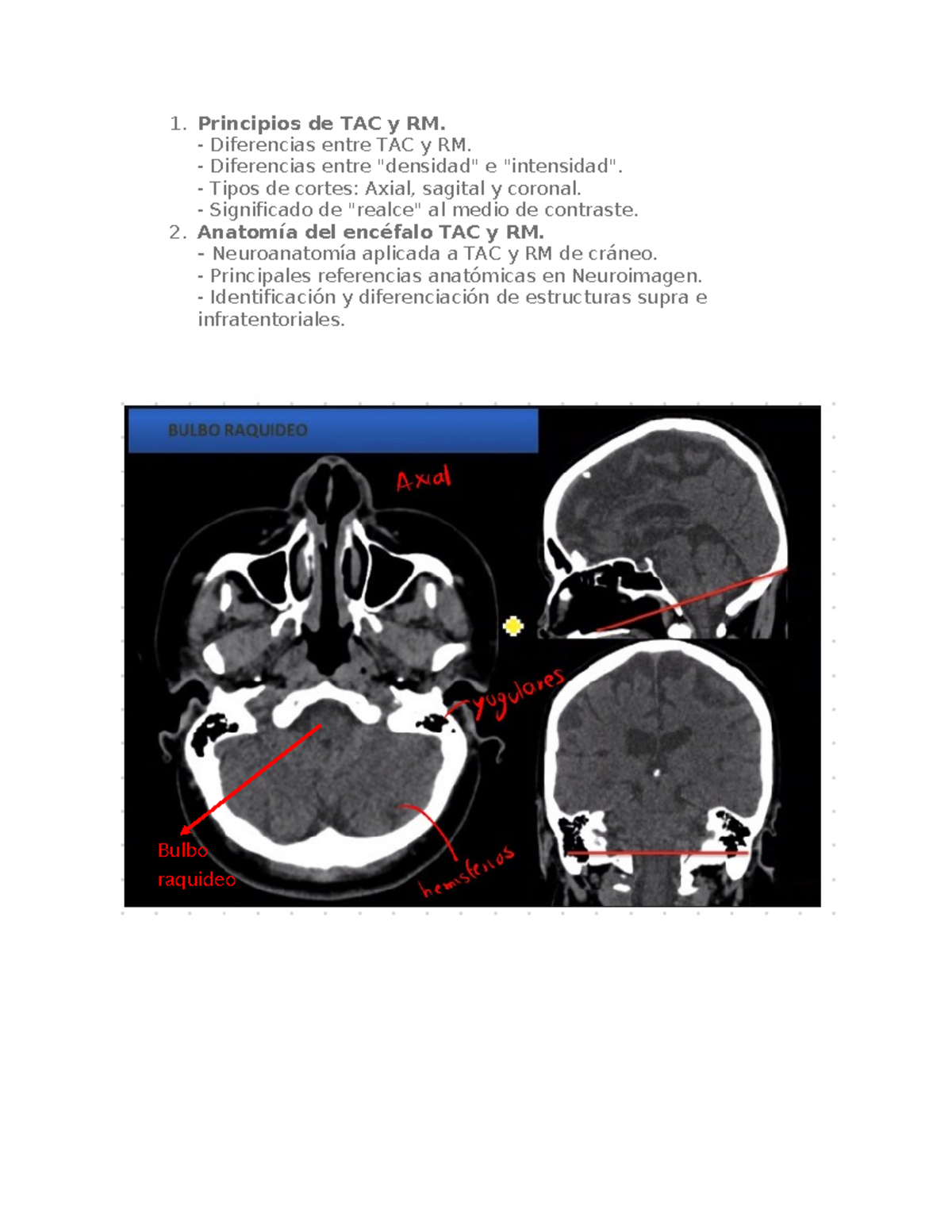Principios de TAC y RM - 1. Principios de TAC y RM. - Diferencias entre ...