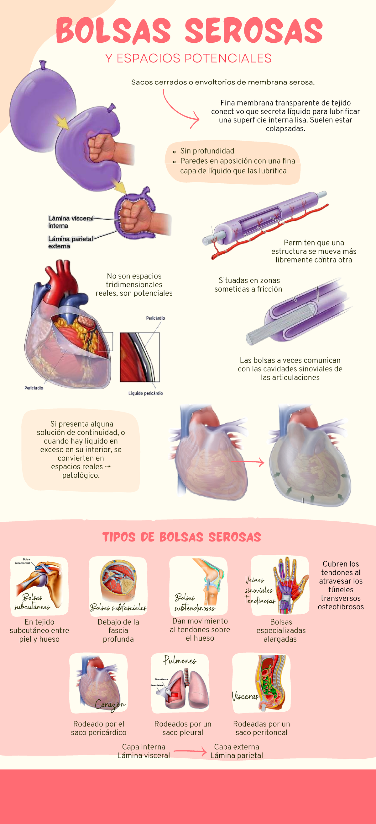 Infografía Bolsas Serosas - Tipos de bolsas serosas En tejido