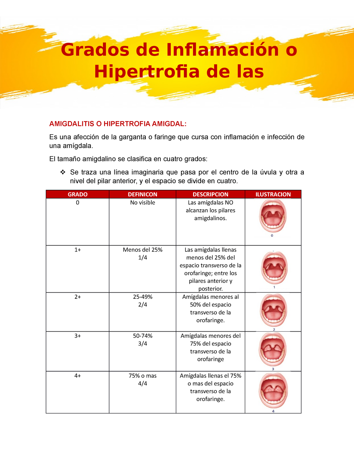 puntuación de hipertrofia amigdalina