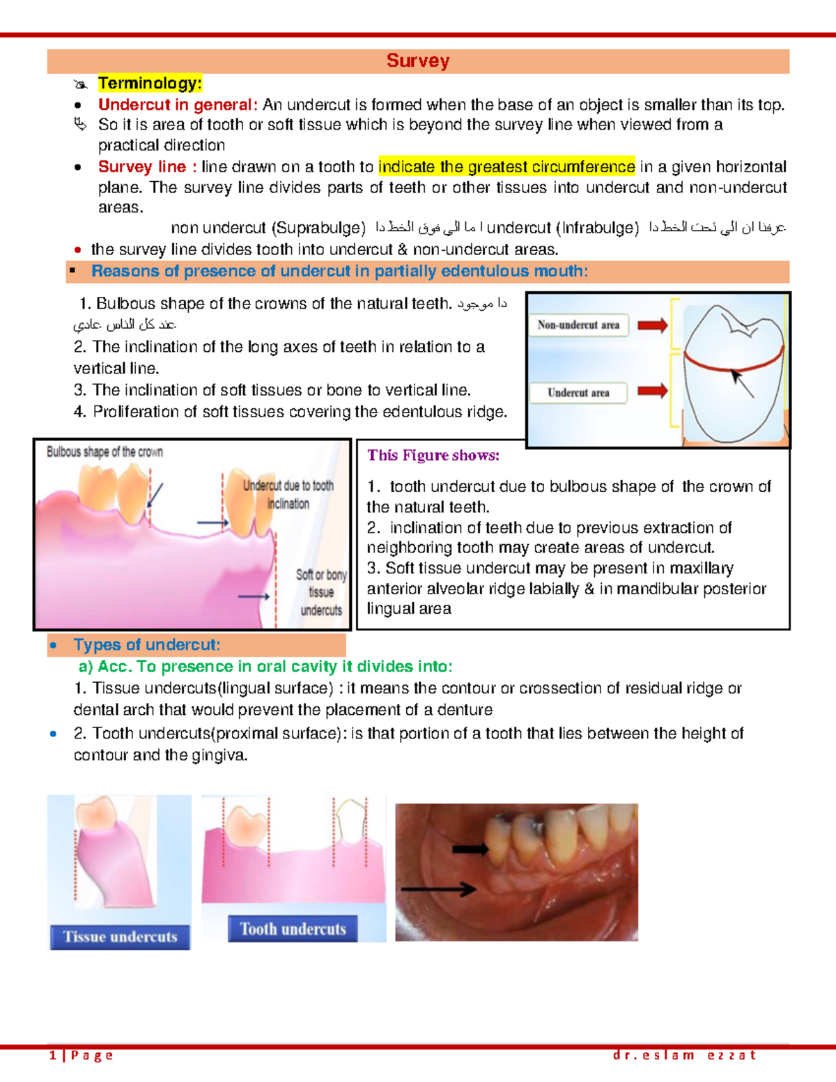 Survey 2023 - Summary prothetic dentistry - Survey Terminology ...