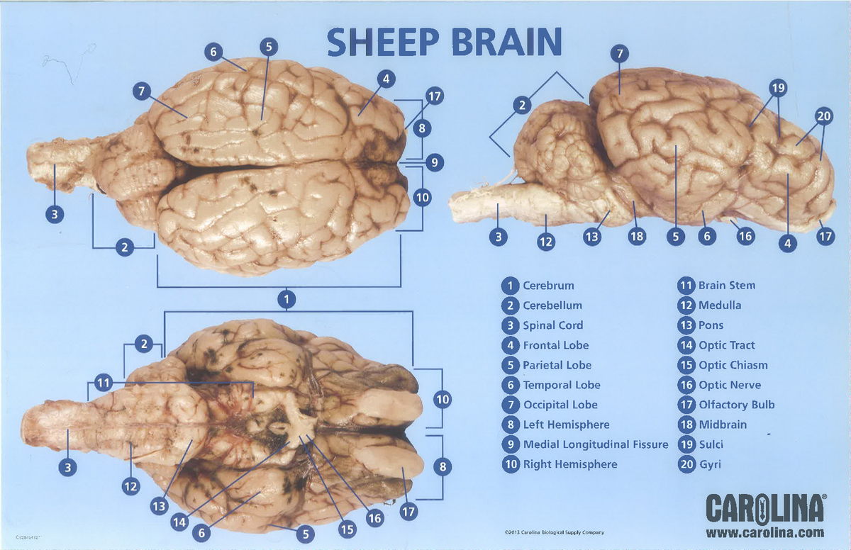 Sheep brain dissection - Bisc 21 - StuDocu Intended For Sheep Brain Dissection Worksheet