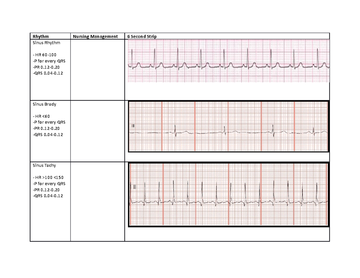 Cardiac handout - Rhythm Nursing Management 6 Second Strip Sinus Rhythm ...