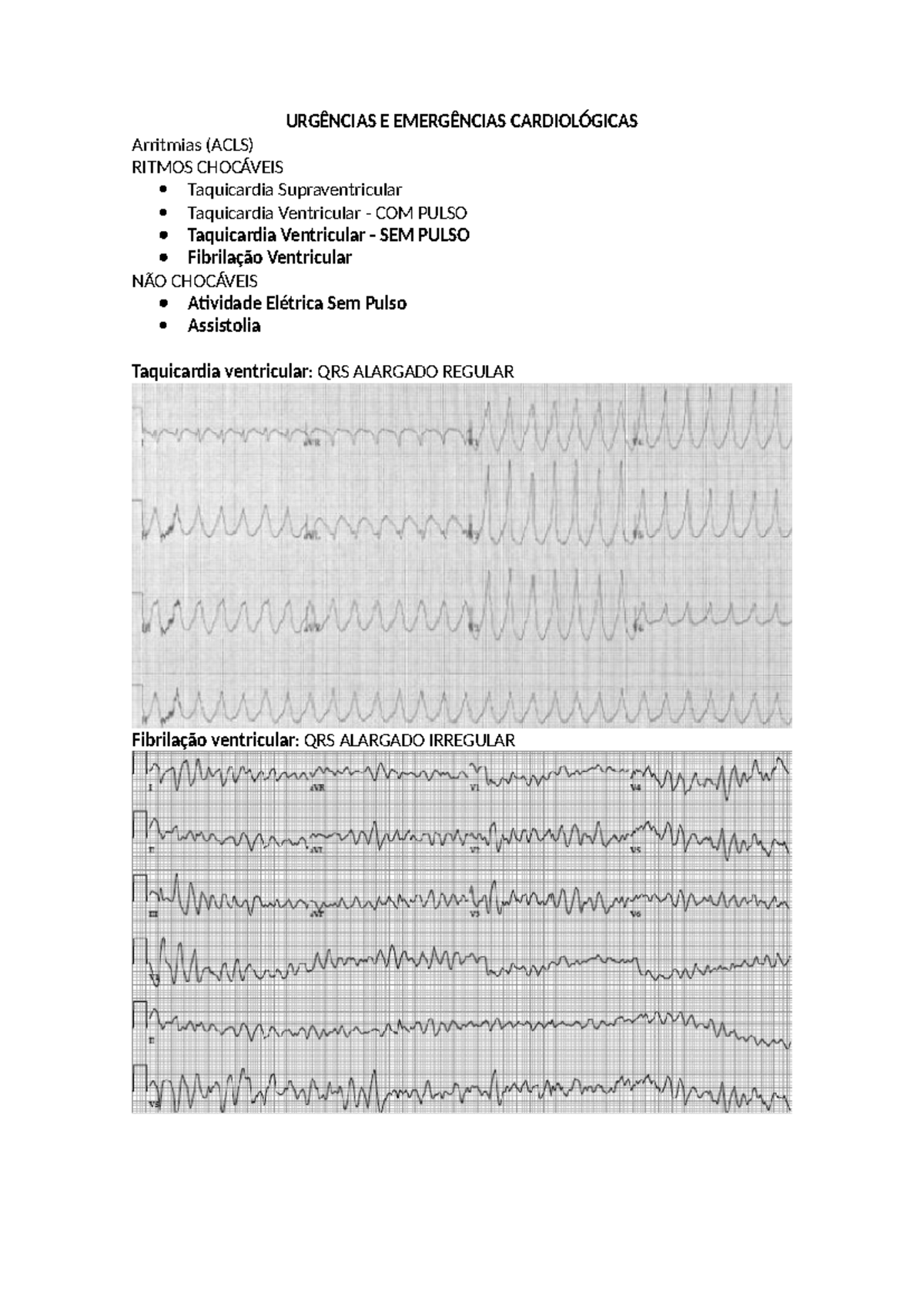 Arritmias (ACLS) - URGÊNCIAS E EMERGÊNCIAS CARDIOLÓGICAS Arritmias ...