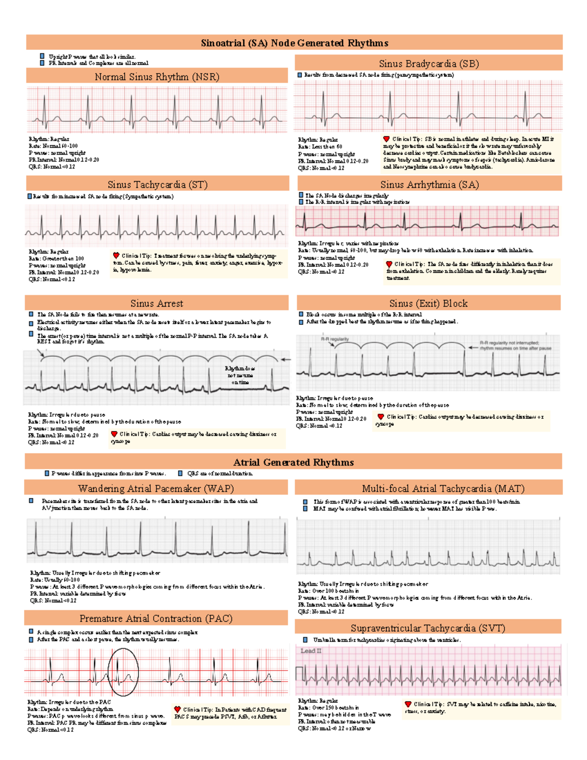 Rhythms - NOtes - Sinoatrial (SA) Node Generated Rhythms Normal Sinus ...