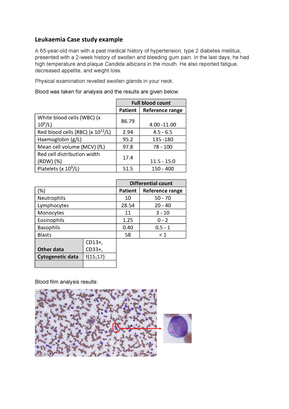 case study of leukaemia