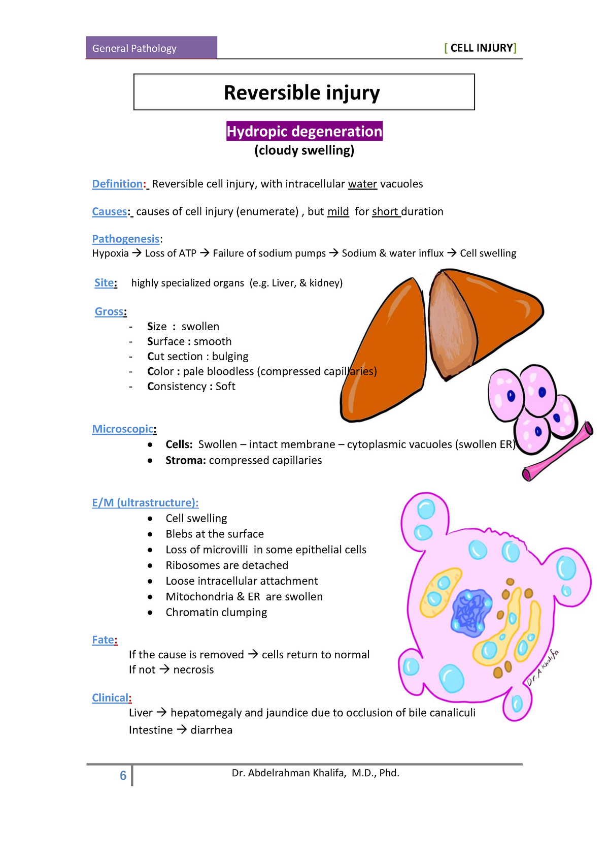 patho-3-reversible-injury-hydropic-degeneration-cloudy-swelling