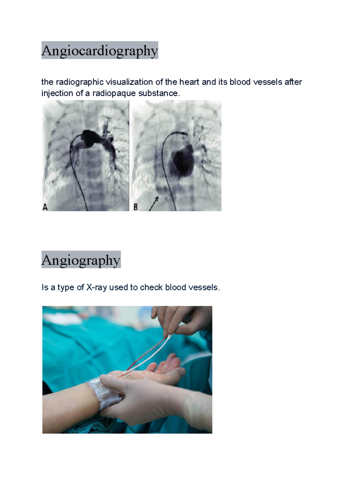 Picture+Vocabulary - Notes - Angiocardiography the radiographic ...