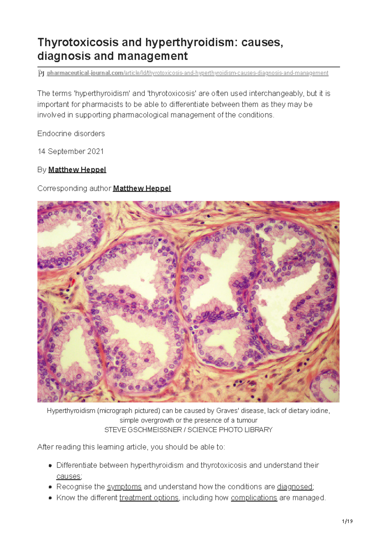 and hyperthyroidism causes
