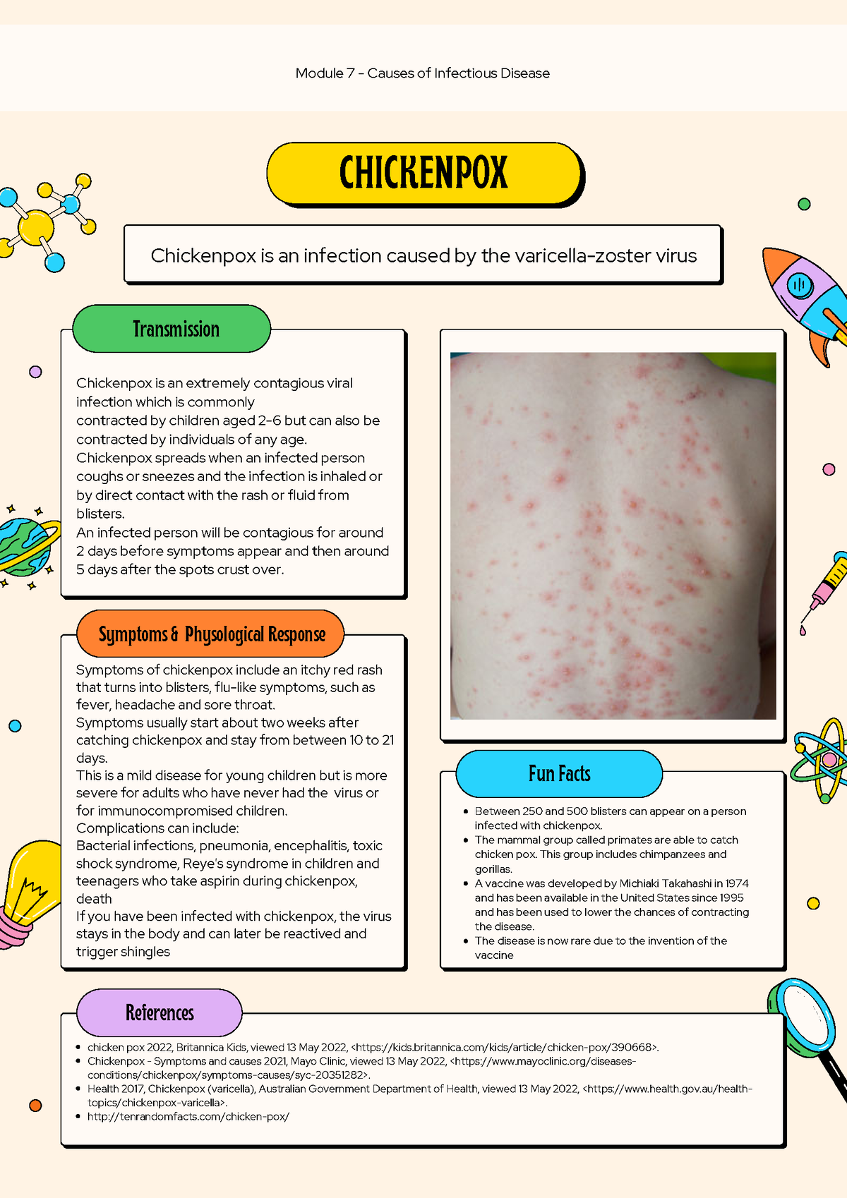 chicken pox research article