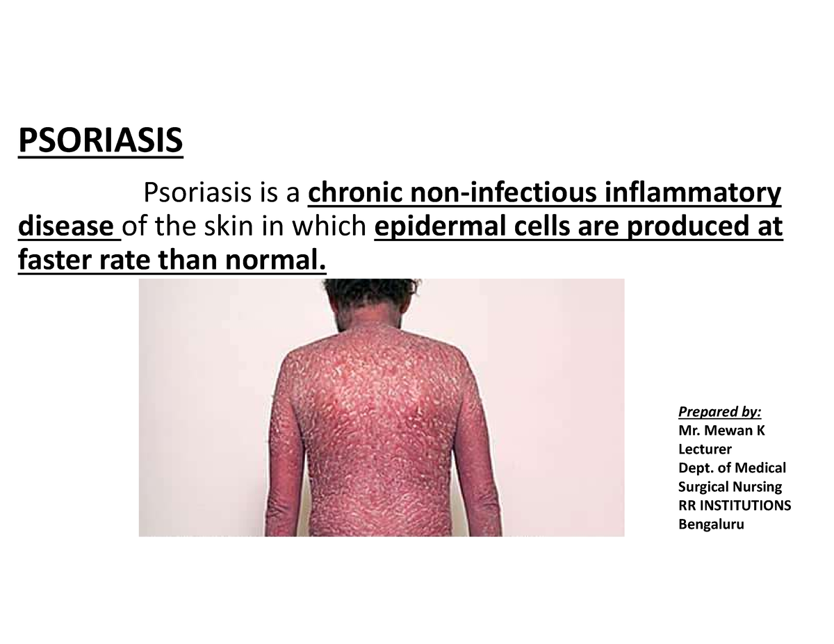 Introduction Of Psoriasis - PSORIASIS Psoriasis Is A Chronic Non ...