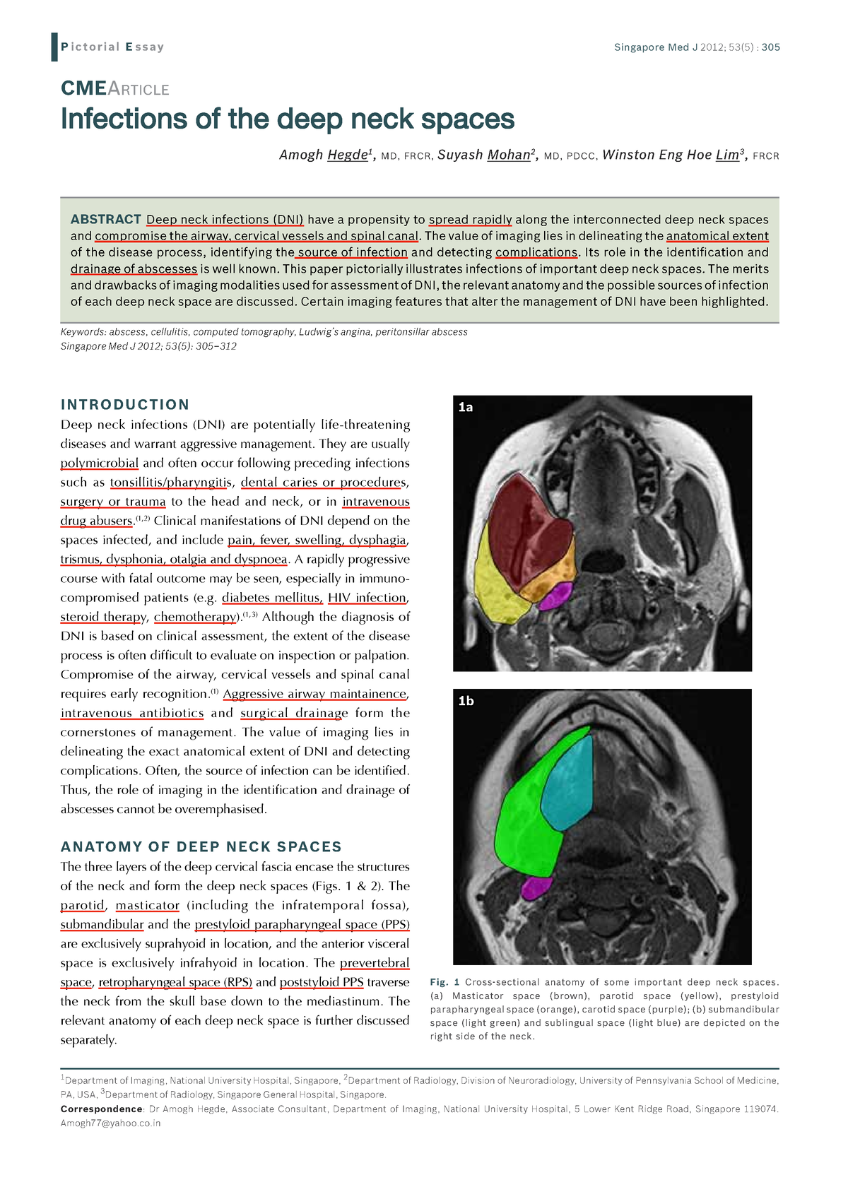 2 Infections Of The Deep Neck Spaces - Hedge A 2012 CME Article - P i c ...