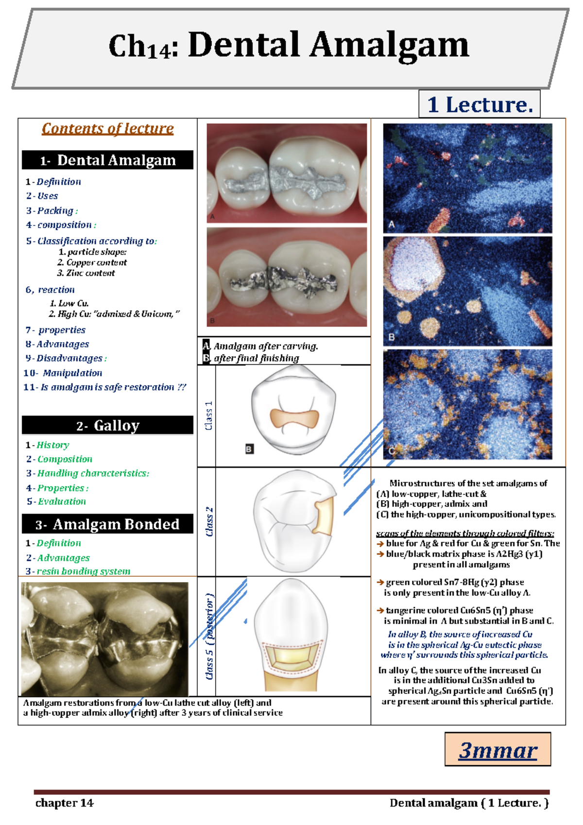14 Amalgam Chapter 14 Dental Amalgam 1 Lecture 1 