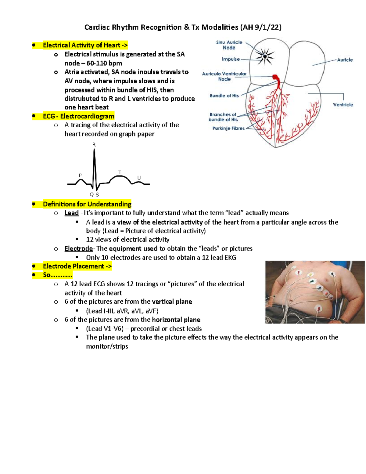 Cardiac Rhythms Notes - Cardiac Rhythm Recognition & Tx Modalities (AH ...