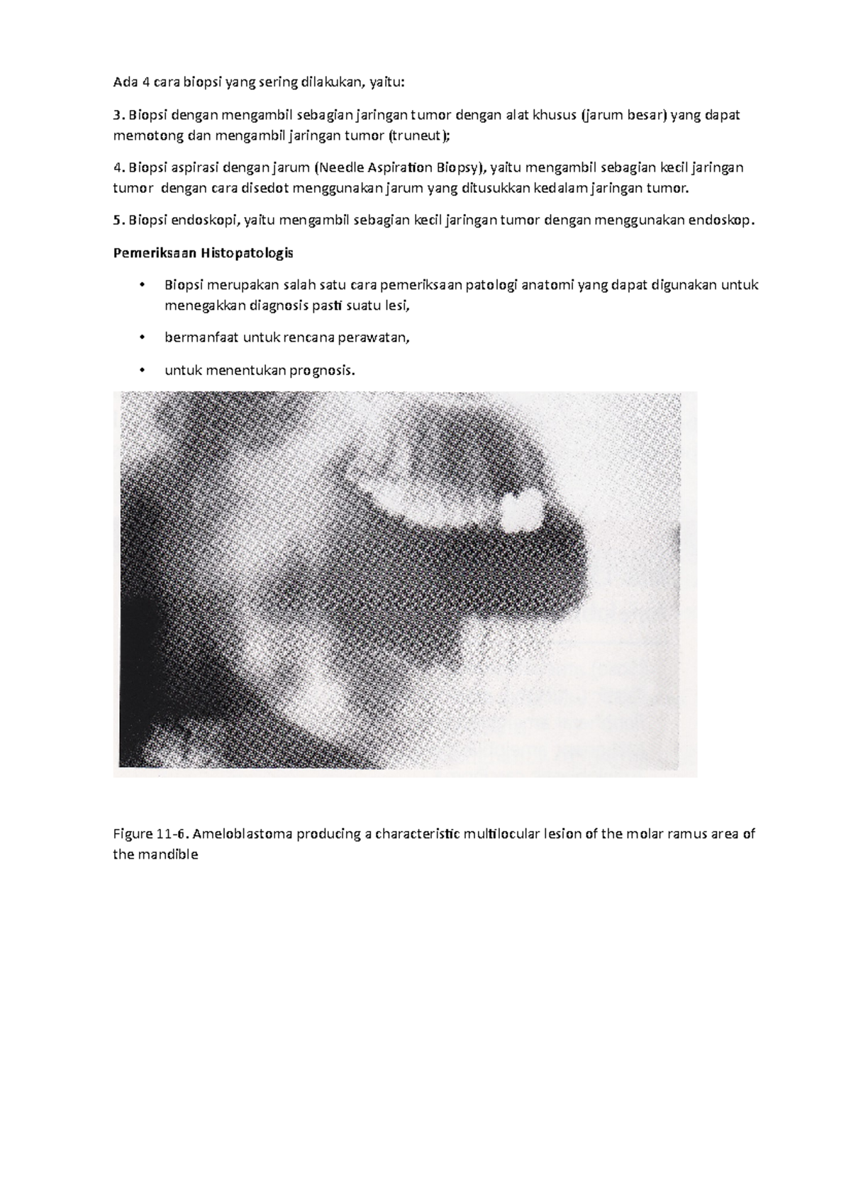 4 cara biopsi Biopsi endoskopi, yaitu mengambil sebagian kecil