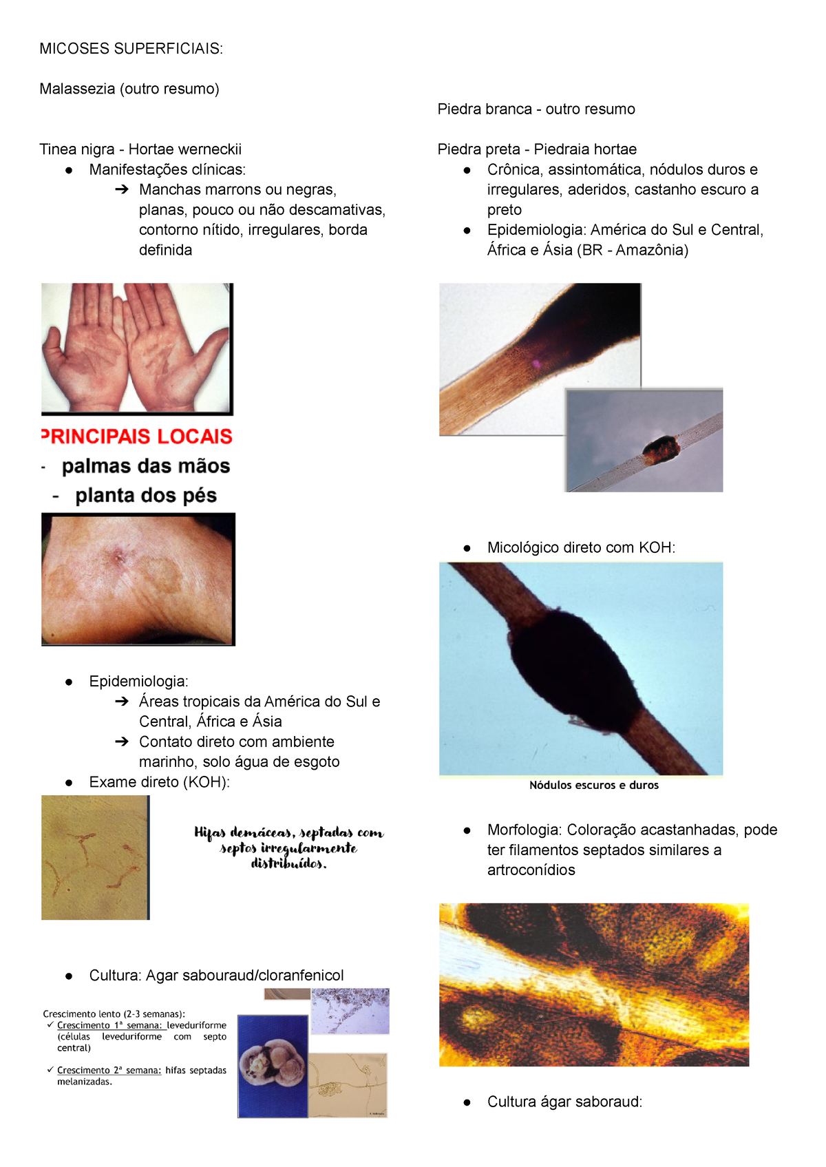 Micro - M2 - Resumo Sobre Micose - MICOSES SUPERFICIAIS: Malassezia ...