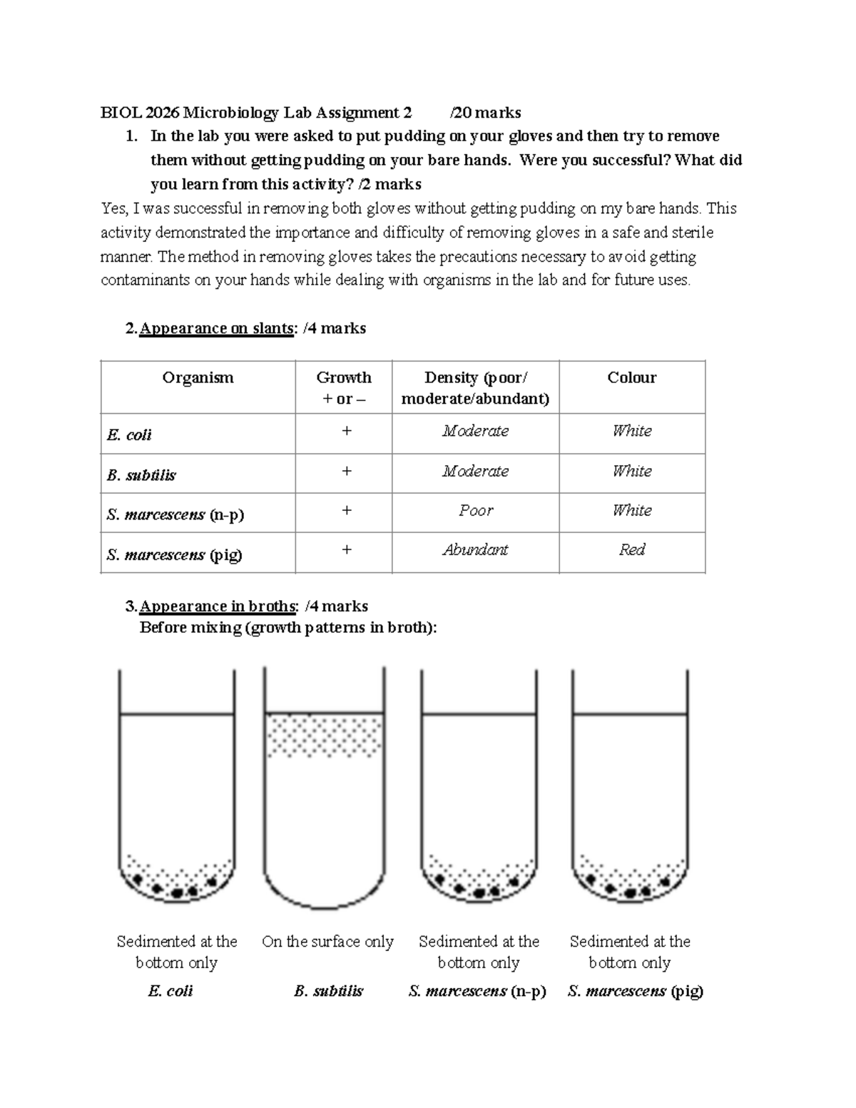 Lab 2 lab assignment 2 BIOL 2026 Microbiology Lab Assignment 2 /20 marks 1. In the lab you