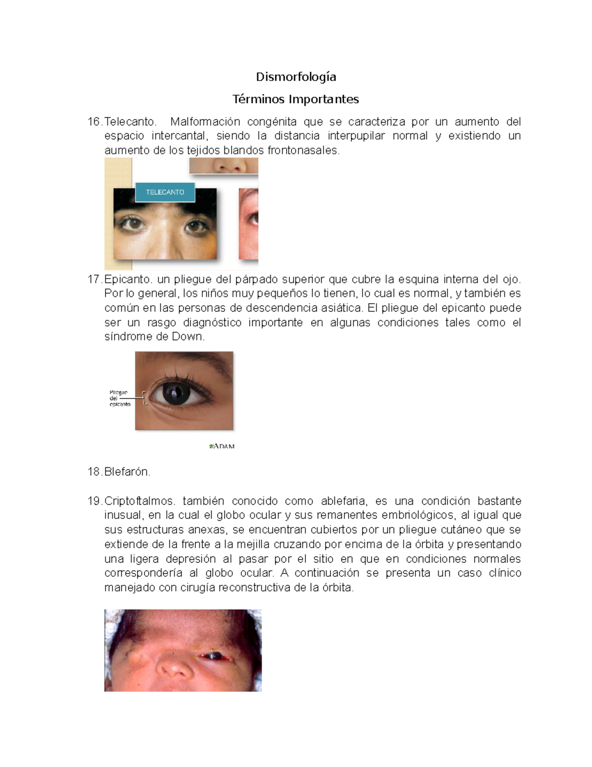 pliegue epicántico vs ojo normal