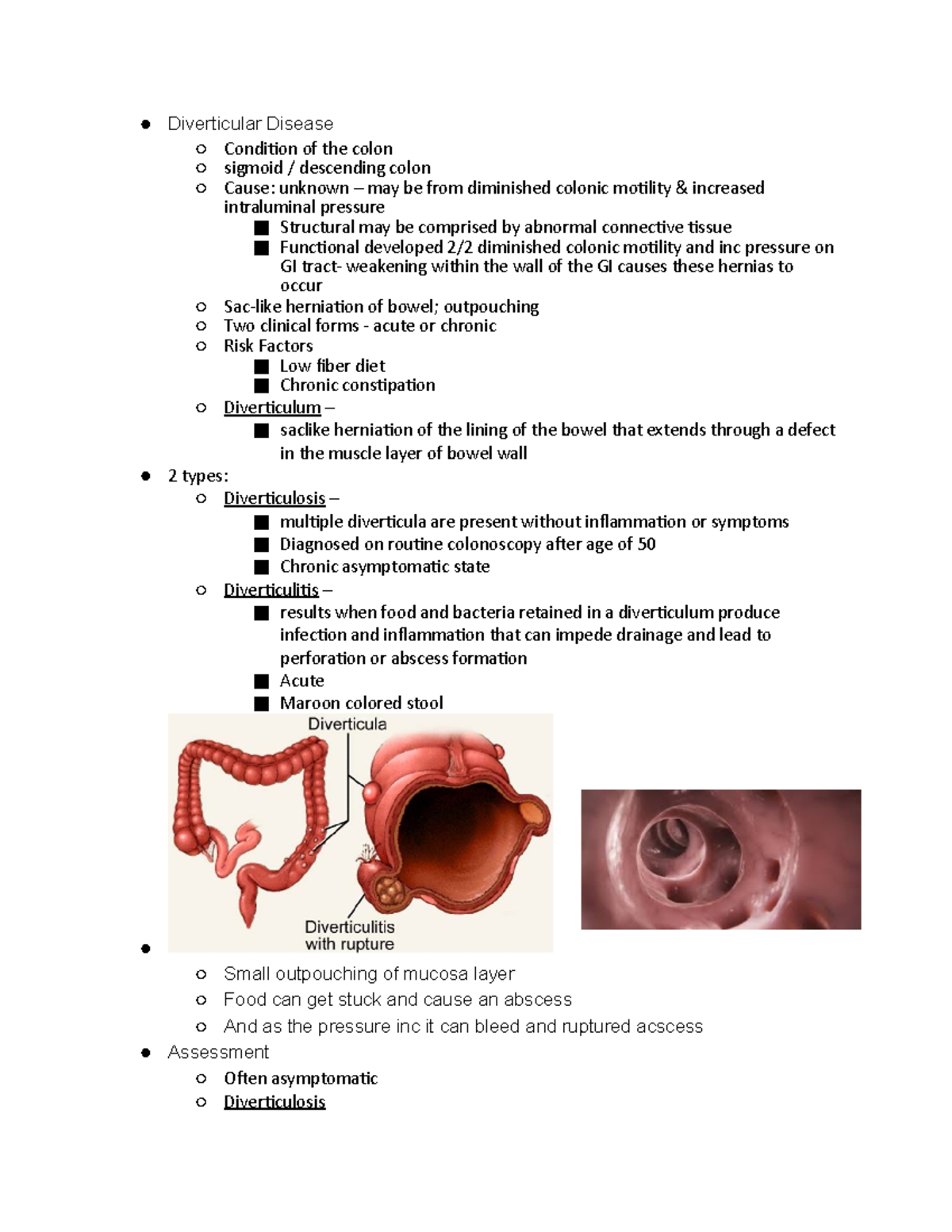Diverticular Disease Medsurg 1 notes McWeeney Diverticular Disease