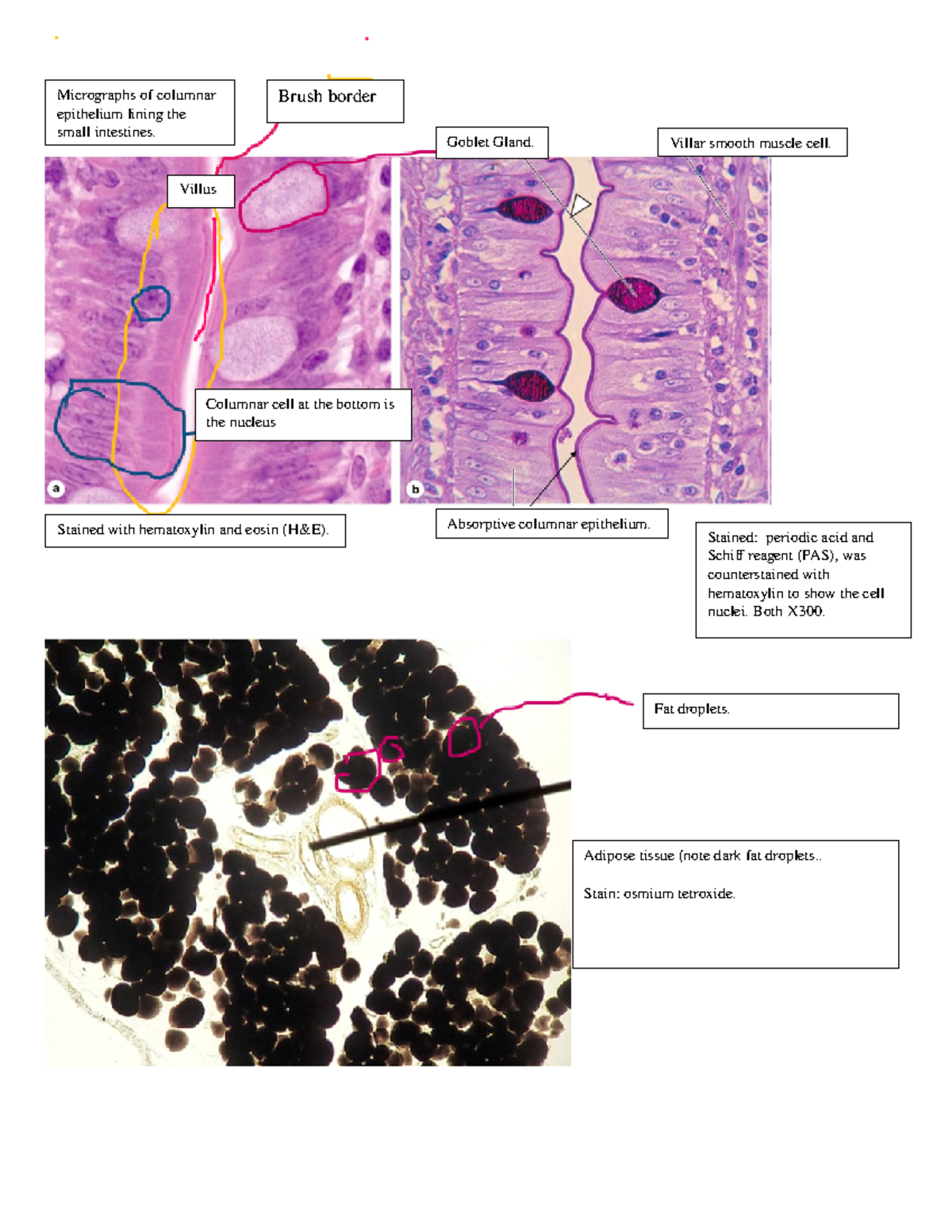 Histology lab pictures Brush border Goblet Gland. Villar smooth