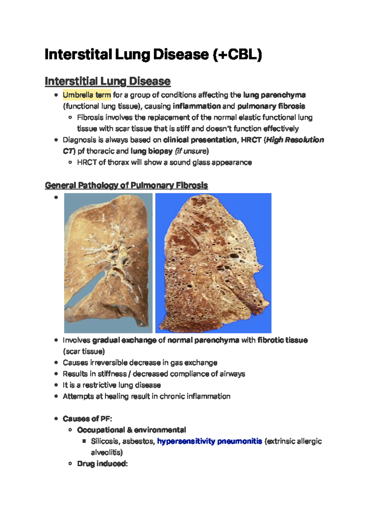 Interstital Lung Disease - I N Te R S T I Ta L L U N G D I S E A S E ...