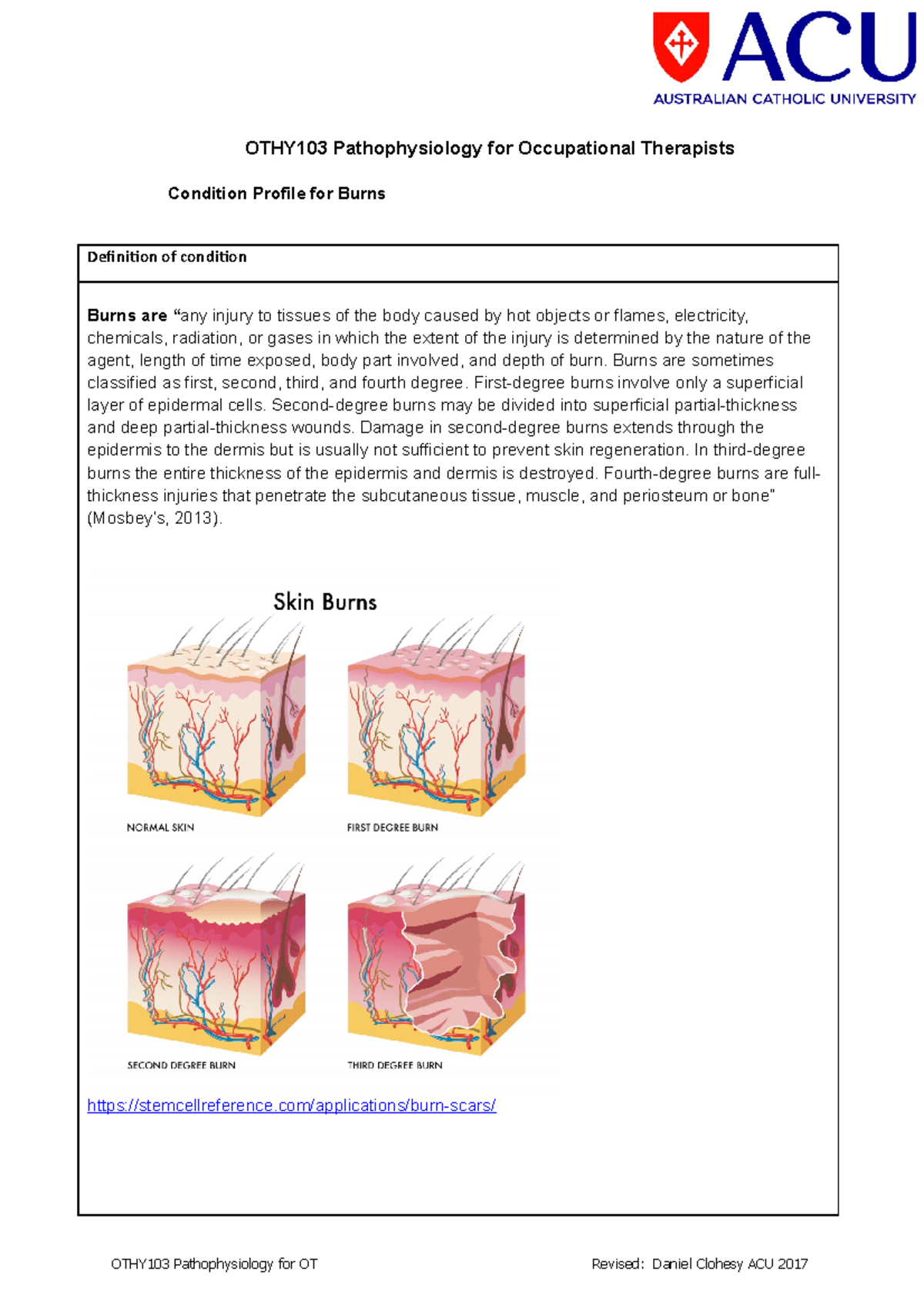 OTHY103 Condition Profile Burns - OTHY103 Pathophysiology for ...