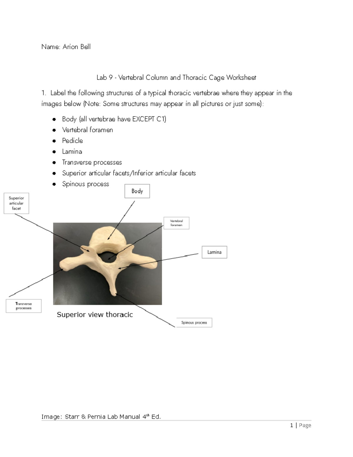 Lab 9 Vertebral Column and Thoracic Cage Label the following