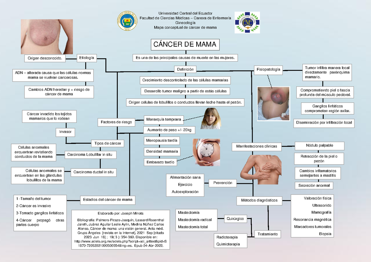 Cáncer de mama Mapa conceptual de Ca de mama Universidad Central del Ecuador Facultad de