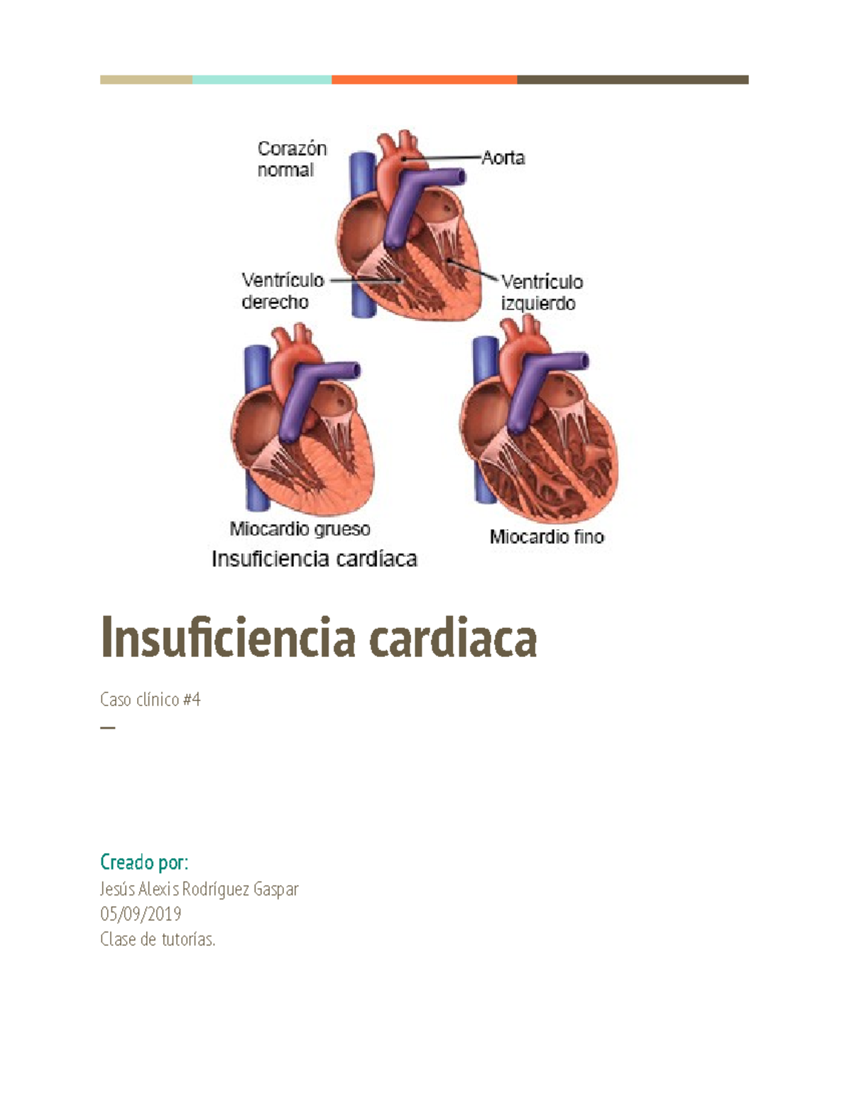 Insuficiencia Cardiaca - Insuficiencia Cardiaca Caso Clínico ─ Creado ...