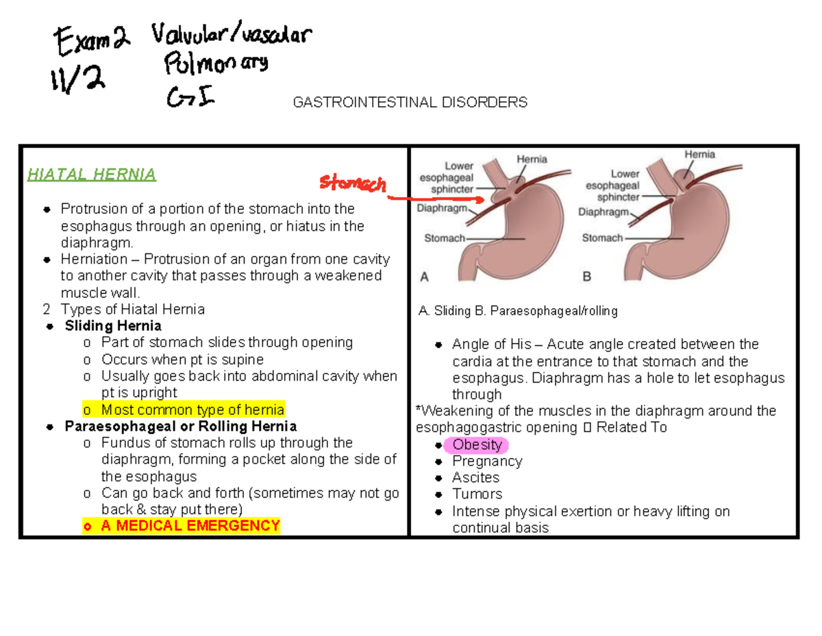 Ch. 41, 42 GIDisorders(38,43) - GASTROINTESTINAL DISORDERS HIATAL ...