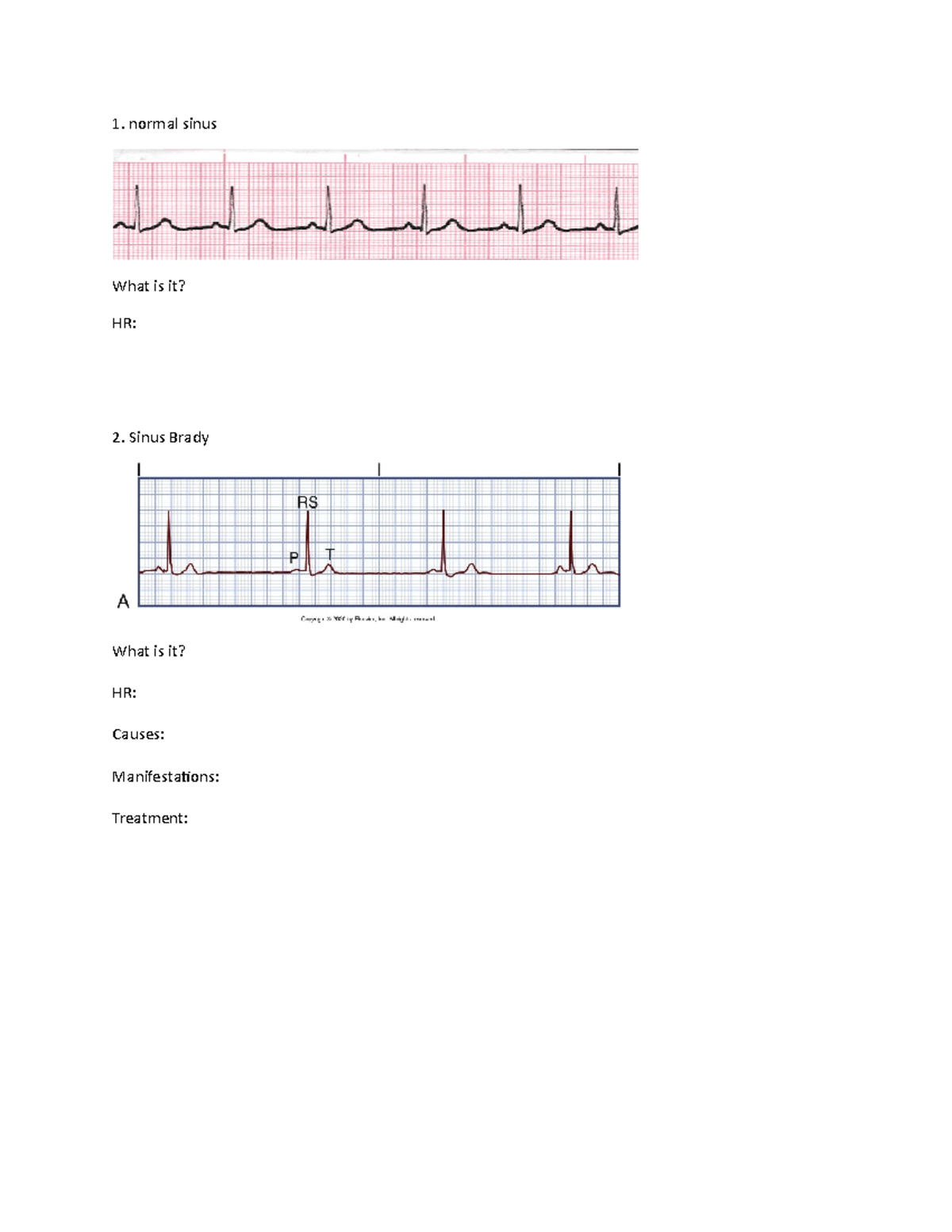 Dysrhythmias Practice - Nurs 461 - Studocu