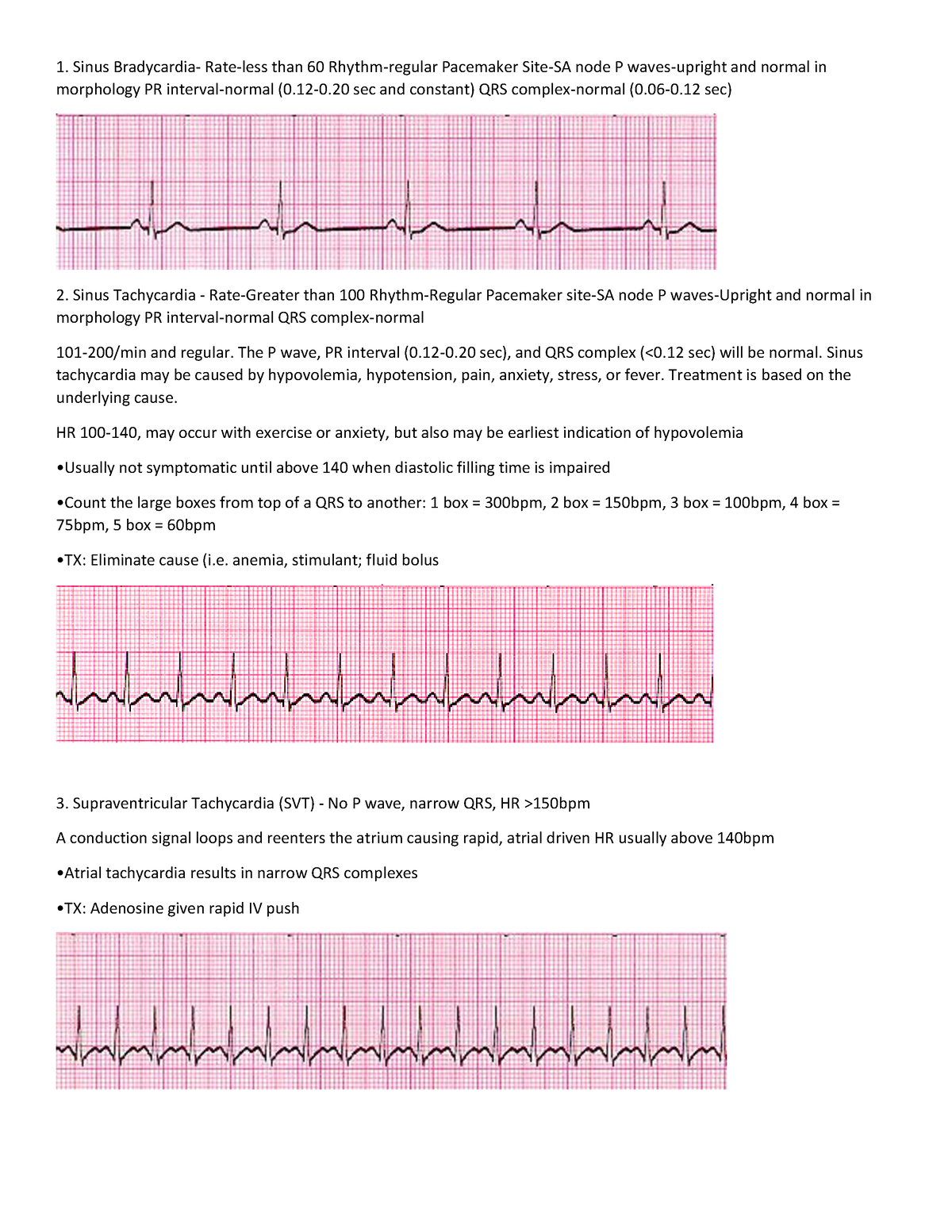 ECG tracing - Heart - Sinus Bradycardia- Rate-less than 60 Rhythm ...