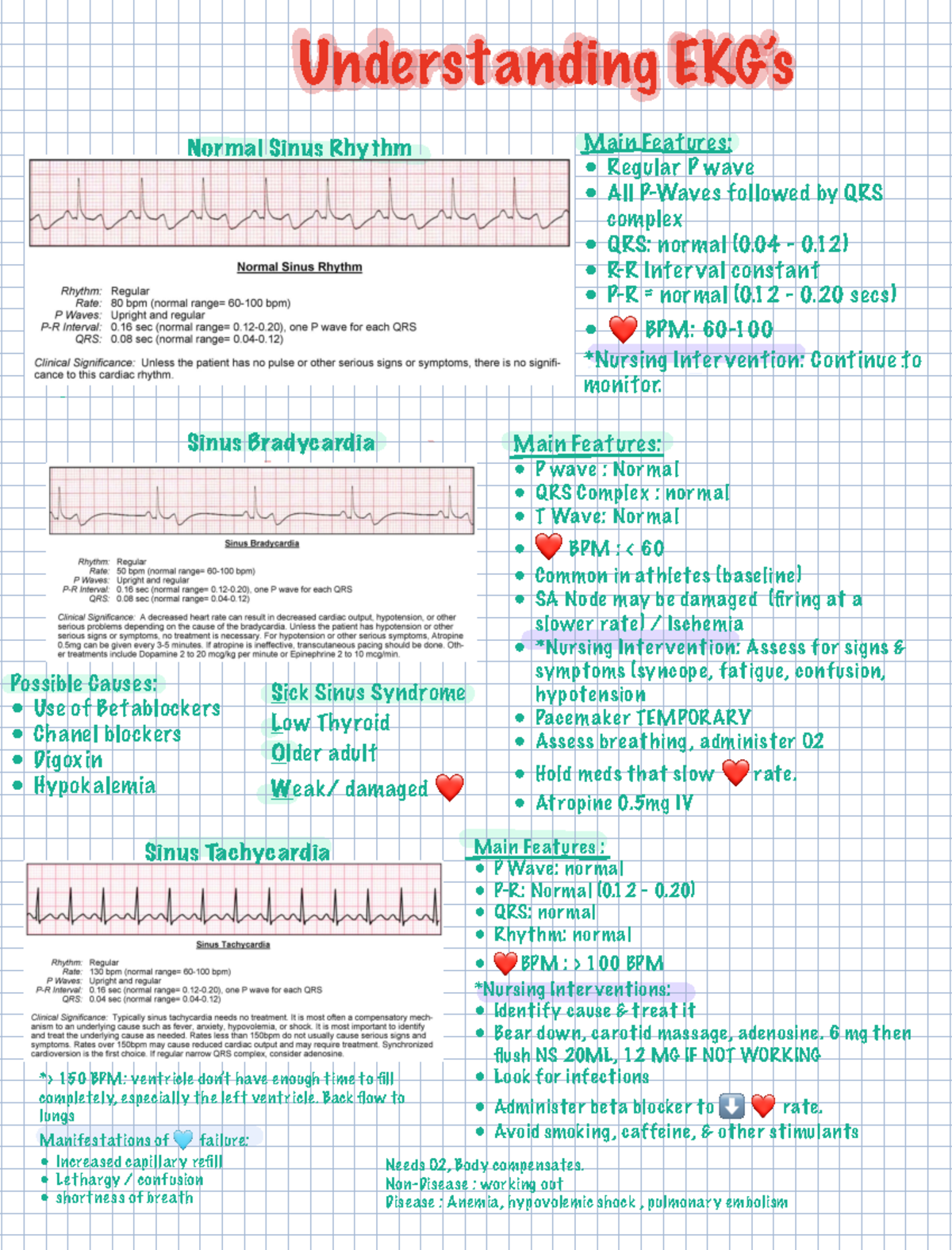 Understanding EKG’s - Main Features: • Regular P wave • All P-Waves ...