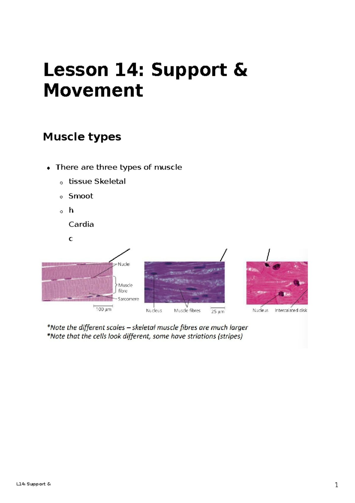 L14 Support and movement L 14 Suppor t & Lesson 14 Support