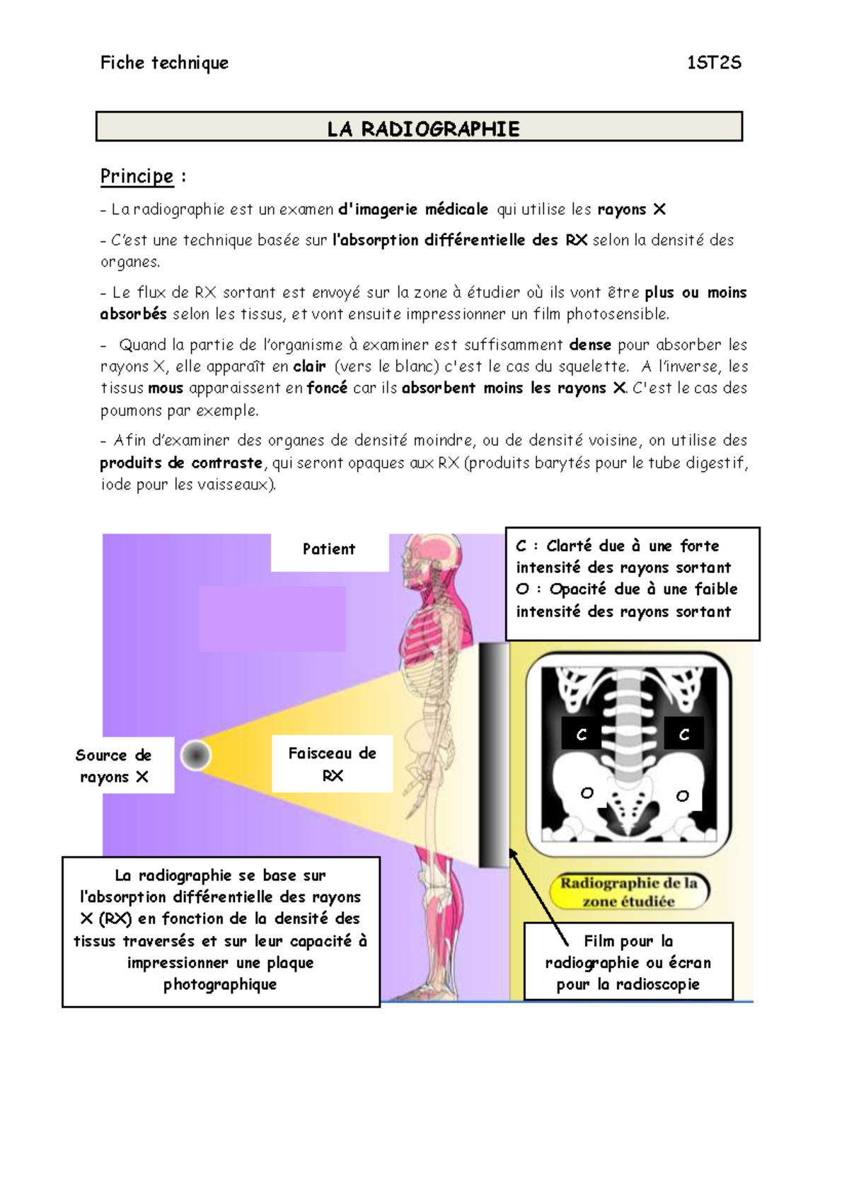 BPH Fiche Radiographie - Fiche technique 1 ST2S LA RADIOGRAPHIE ...