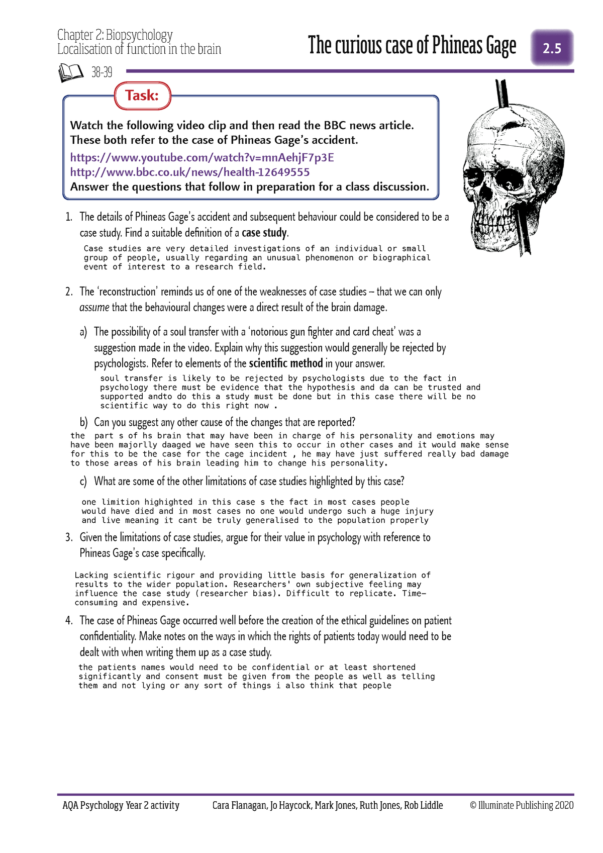 localisation of function case study