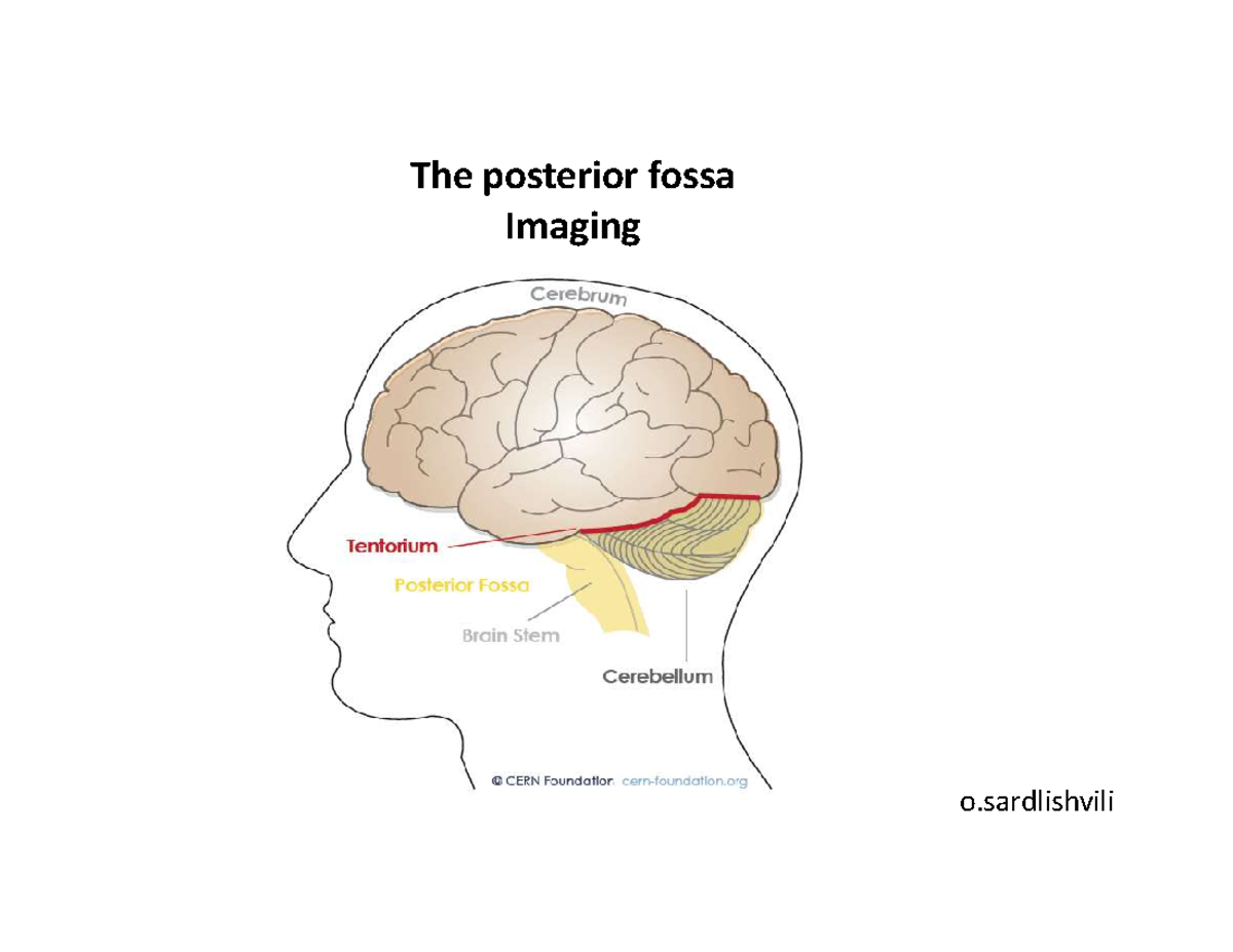 Posterior Fossa - The posterior fossa Imaging o 7. Superior medullary ...