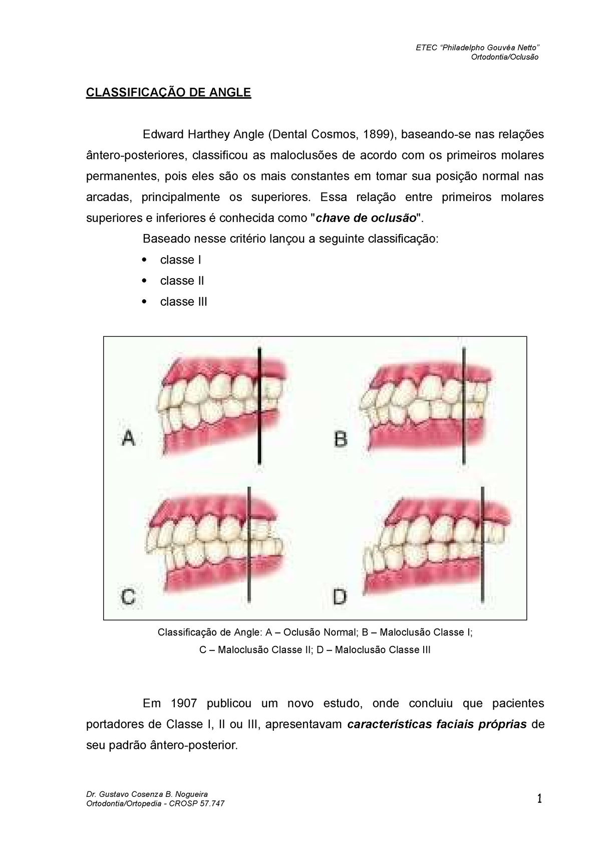 Classificac 3a7c3a3o-de-angle - ETEC “Philadelpho Gouvêa  Netto”Ortodontia/Oclusão Dr. Gustavo - Studocu
